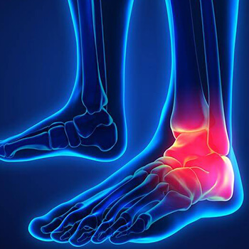 Shin, Ankle & Foot Pain Treatment